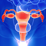 Imagen ilustrativa de cancer de uterino