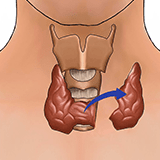 Imagen ilustrativa tiroidectomia
