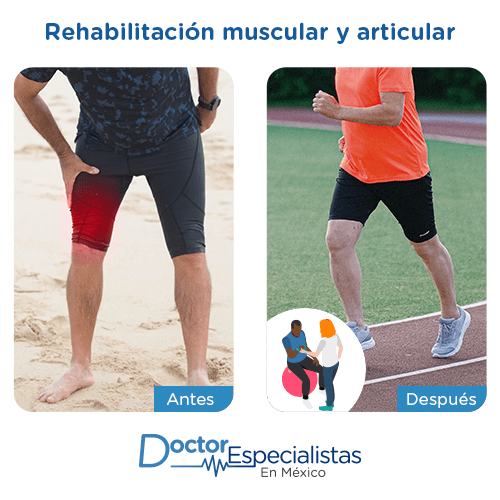 Rehabilitacion muscular y articular imagen ilustrativa