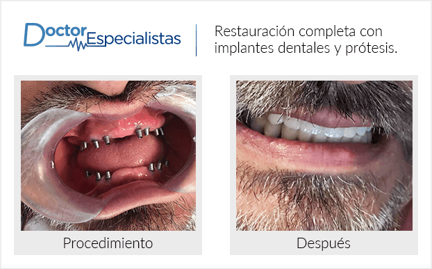 Paciente dentista Ciudad Juárez antes y despues