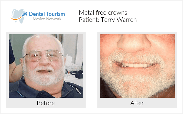 Paciente dentista
                                         Ciudad Juárez antes y despues