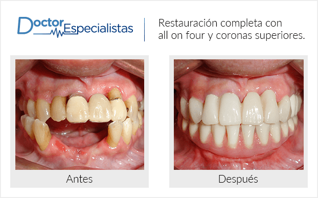 Paciente dentista
                                         Monterrey antes y despues