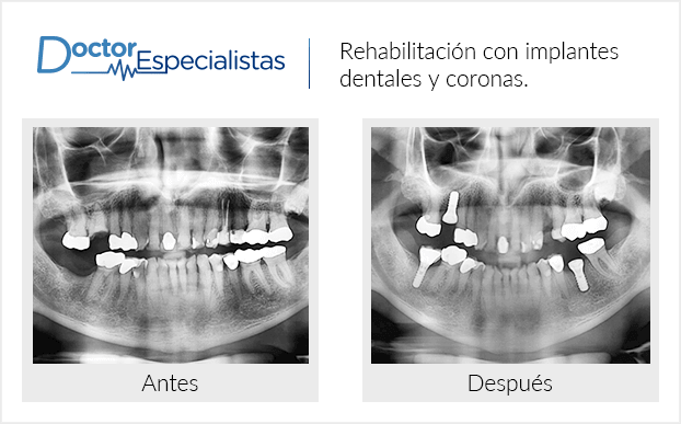 Paciente dentista
                                         Nogales antes y despues