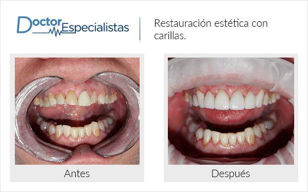 Paciente dentista
                                         Nogales antes y despues