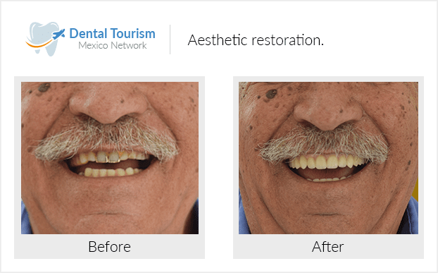 Paciente dentista
                                         Piedras Negras antes y despues