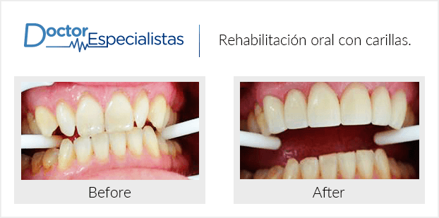 Paciente dentista Los Cabos antes y despues