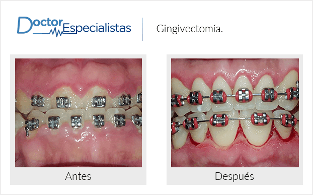 Paciente dentista
                                         Tijuana antes y despues